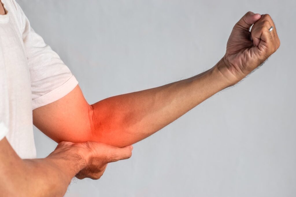 Bursitis